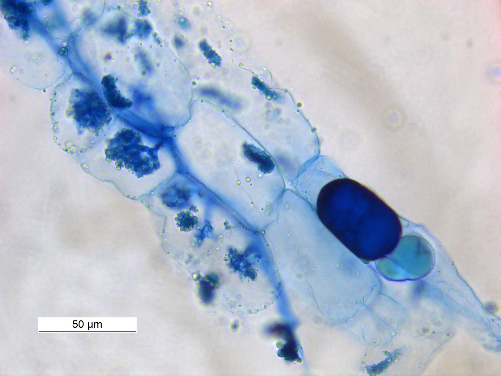 Microscope view of a stained root: rows of pale cells, several holding branched dark-blue clusters, fine blue threads running between them, and a dark blue oval near the lower right, with a 50 micrometer scale bar